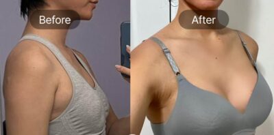 Meme Büyütme süreçleri