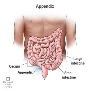Apandisit Ameliyatı Belirtileri ve Tedavi Süreci