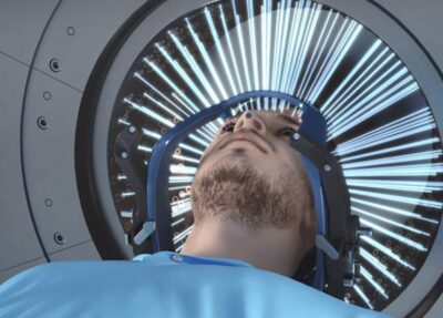 Gama Knife Uygulama Alanları