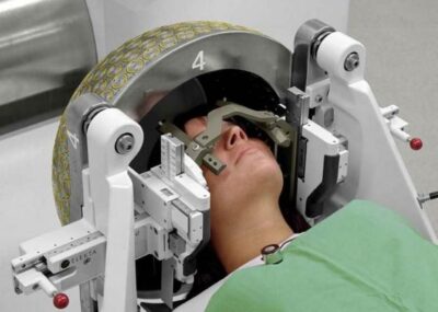 Türkiye'de Ameliyatsız Beyin Tümörü Tedavisi