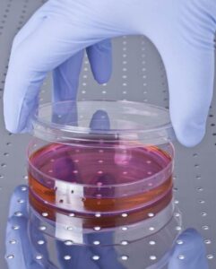 Hücresel Yenilenme Tedavisinin Hedeflediği Hastalıklar