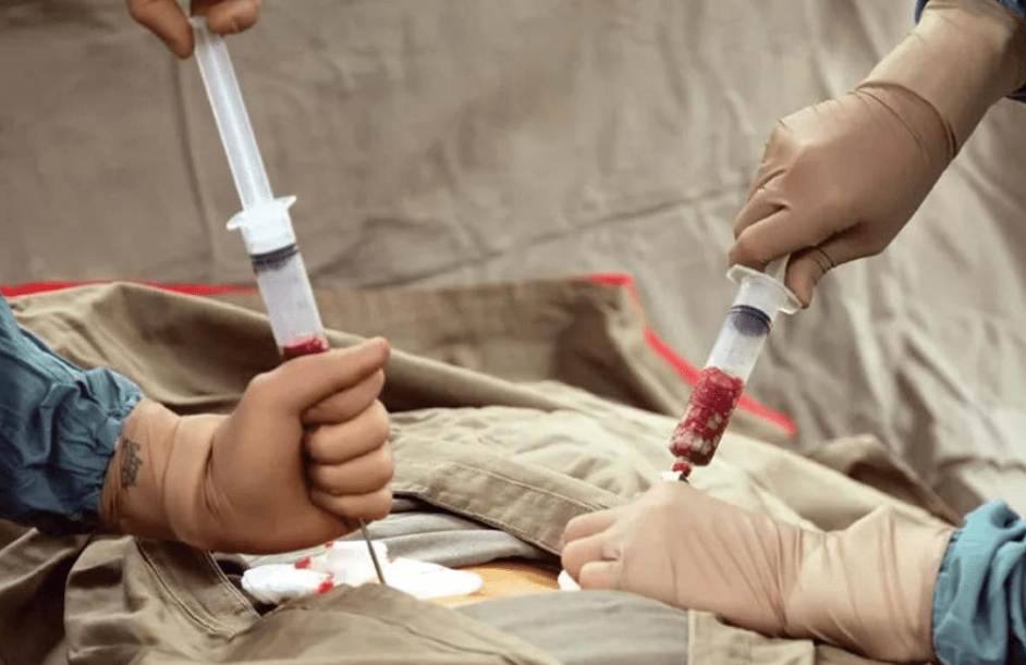 Türkiye'de Kemik İliği Nakli