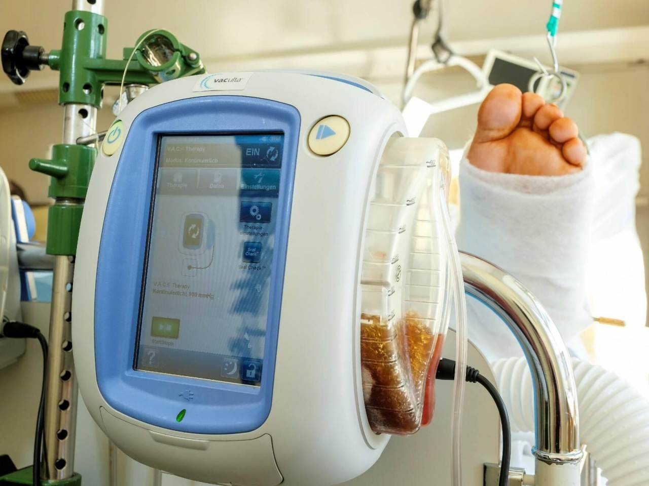 Türkiye’de Yara Bakımı Süreci